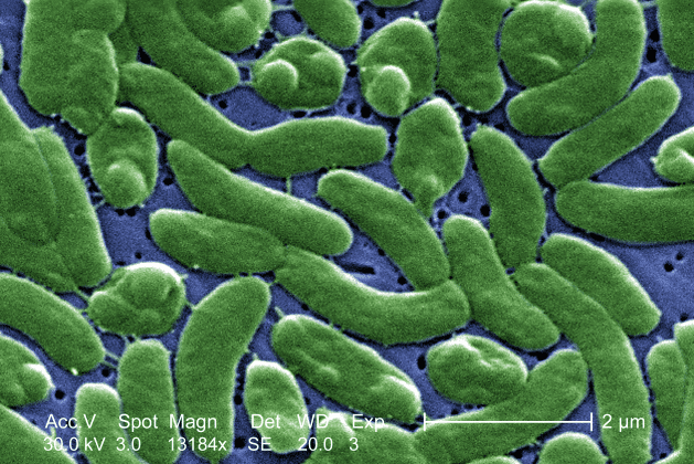 vibrio vulnificus